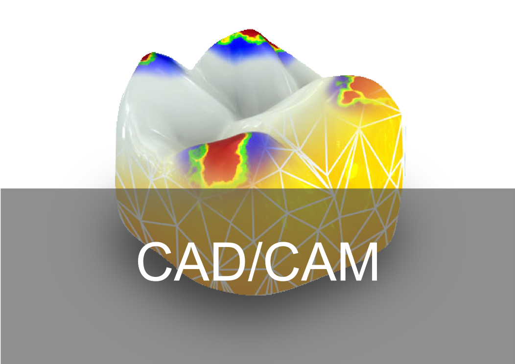 CADCAM Digital - Bremadent Dental Laboratory in London