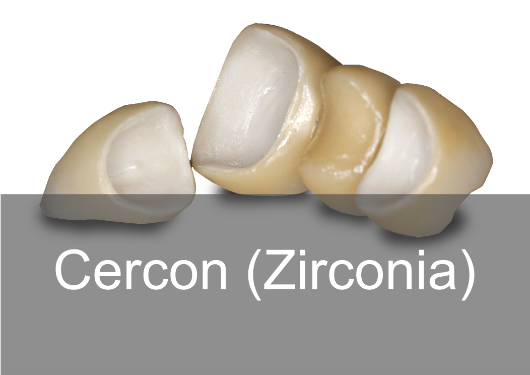 Cercon Zirconia - BPL Dental Laboratory London