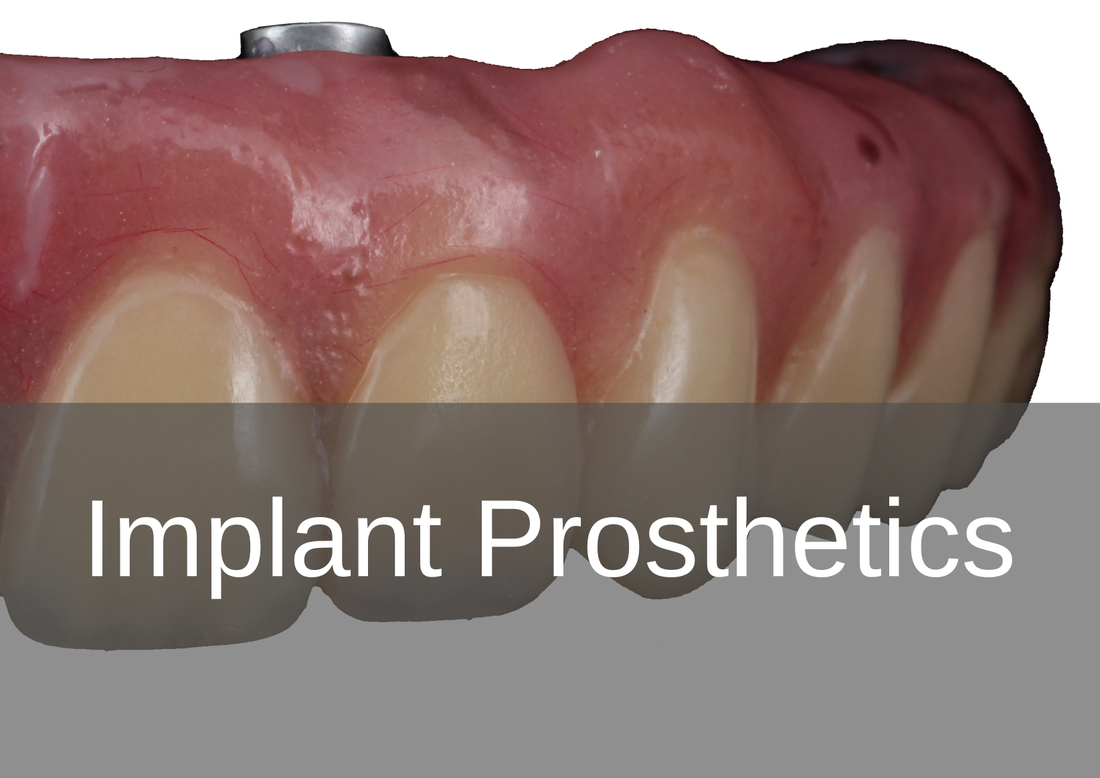 Implant Prosthetics - Bremadent Dental Laboratory, London