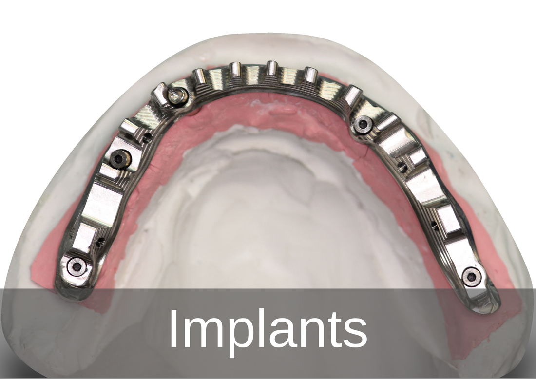 Implantology - BPL Dental Laboratory London 