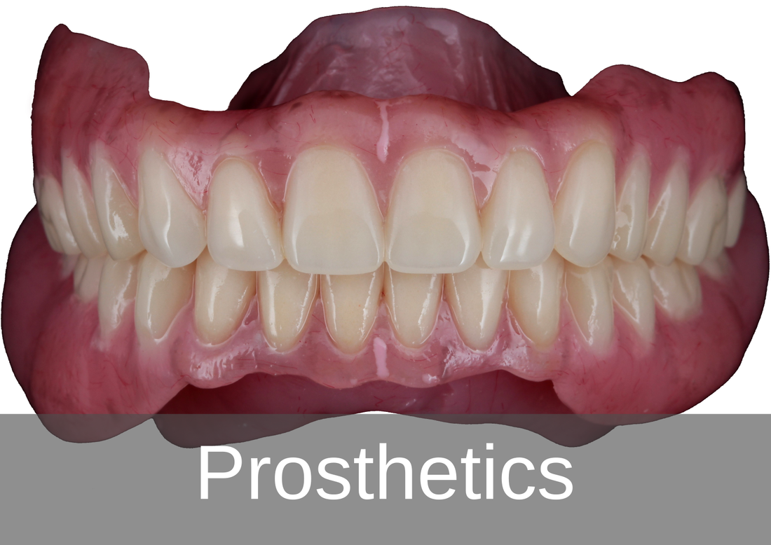 Prosthetics - BPL Dental Laboratory London 