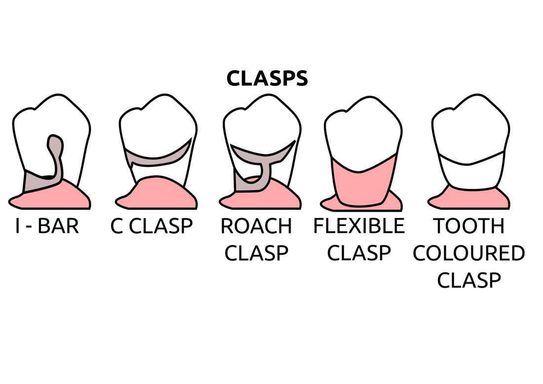 Partial Denture Clasps