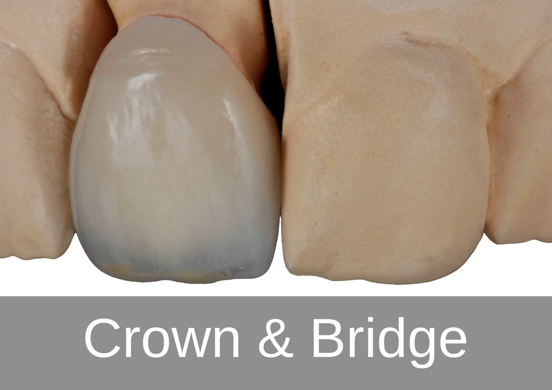 Crown & Bridge - Bremadent Dental Laboratory, London