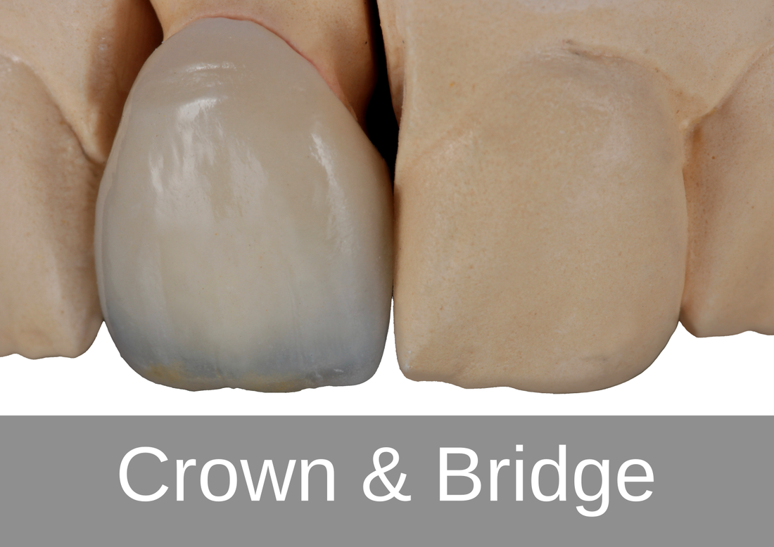 Crown & Bridge -  Bremadent Dental Laboratory, London