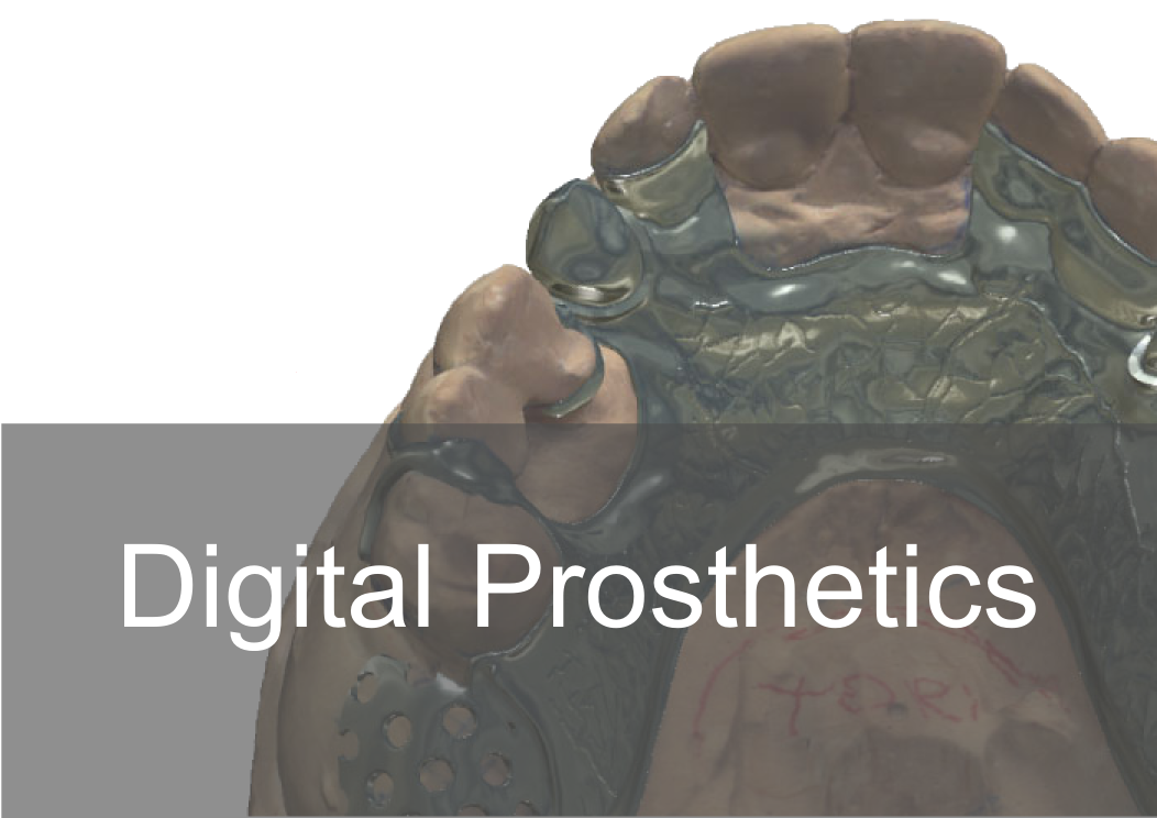 Digital Prosthetics - Bremadent Dental Laboratory in London 