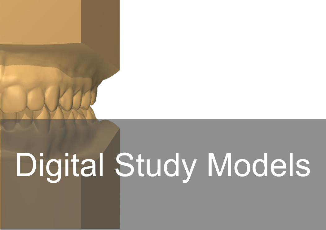 Digital Dental Study Model - Bremadent Dental Laboratory in London 