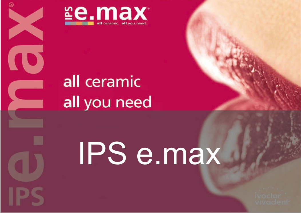 IPS e.max - BPL Dental Laboratory London