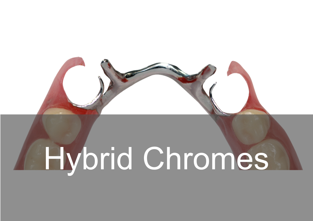 Hybrid Chromes at Bremadent Dental Laboratory