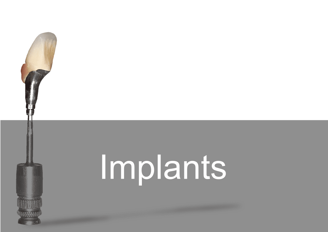 Implant Crown & Bridge - Bremadent Dental Laboratory 