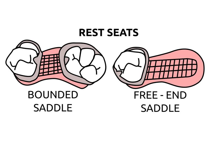 Rest seat - RPI design for rpds 